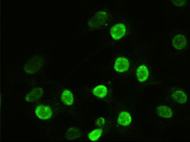 m02635 1 anti alpha actinin actn1 mouse monoclonal antibody clone id oti7a4 if testing 10