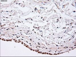 m02635 1 anti alpha actinin actn1 mouse monoclonal antibody clone id oti7a4 ihc testing 7