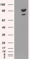 HEK293T cells were transfected with the pCMV6-ENTRY control (Left lane) or pCMV6-ENTRY ACTN1 (Right lane) cDNA for 48 hrs and lysed