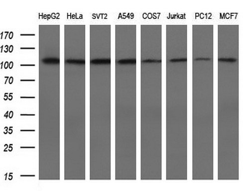 Western blot analysis of extracts (10ug) from 8 different cell lines by using anti-ACTN1 monoclonal antibody at 1:200 dilution