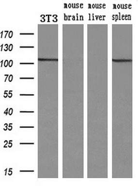 Western blot analysis of extracts (10ug) from a mouse cell line and 3 different mouse tissues by using anti-ACTN1 monoclonal antibody (1:200)
