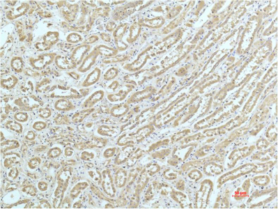 Immunohistochemical analysis of paraffin-embedded Human Kidney Tissue using a-actinin Mouse mAb diluted at 1:200