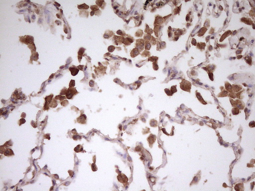 m02636 anti pcbp1 mouse monoclonal antibody clone id oti3d12 ihc testing 3