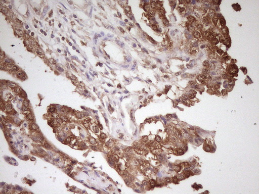 m02636 anti pcbp1 mouse monoclonal antibody clone id oti3d12 ihc testing 4