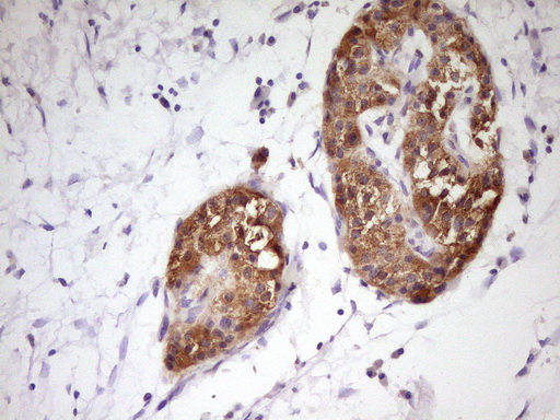 m02636 anti pcbp1 mouse monoclonal antibody clone id oti3d12 ihc testing 5