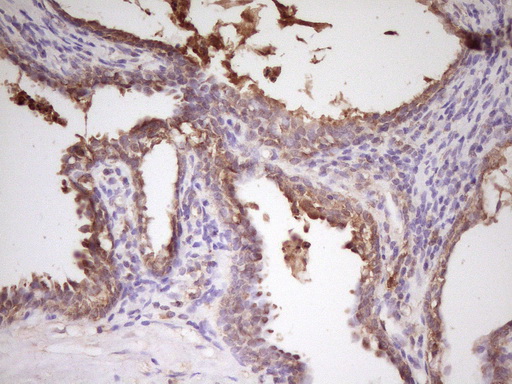 m02636 anti pcbp1 mouse monoclonal antibody clone id oti3d12 ihc testing 6