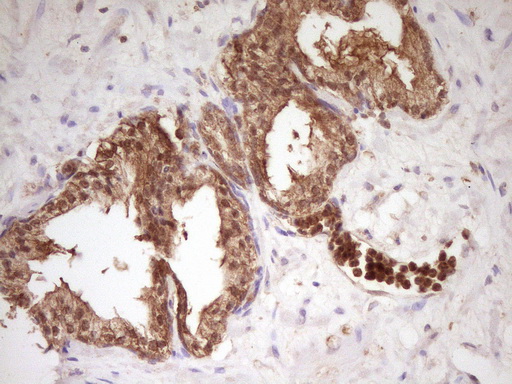 m02636 anti pcbp1 mouse monoclonal antibody clone id oti3d12 ihc testing 7