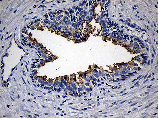 m02638 anti pip5k3 pikfyve mouse monoclonal antibody clone id oti1d2 ihc testing 2