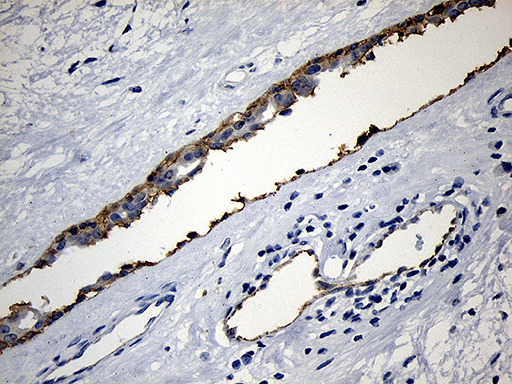 m02638 anti pip5k3 pikfyve mouse monoclonal antibody clone id oti1d2 ihc testing 3