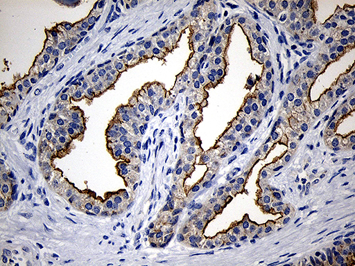 m02638 anti pip5k3 pikfyve mouse monoclonal antibody clone id oti1d2 ihc testing 4