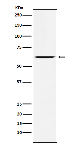 Western blot analysis of Yes1 expression in SW480 cell lysate