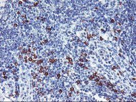 m02644 anti igj jchain mouse monoclonal antibody clone id oti3b3 ihc testing 3