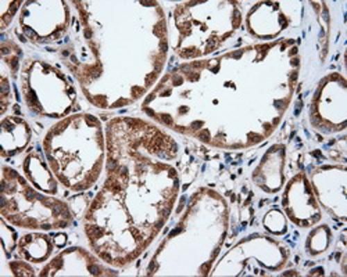 m02652 ifit1 primary antibodies ihc testing 3