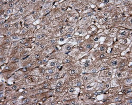 m02652 ifit1 primary antibodies ihc testing 4