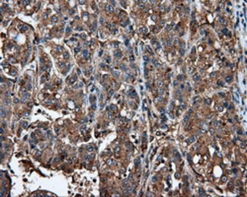 m02652 ifit1 primary antibodies ihc testing 5