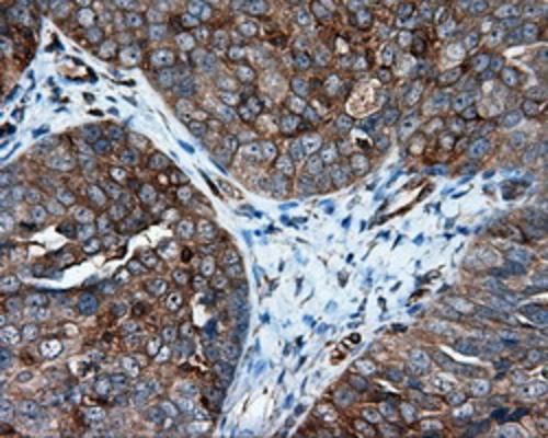 m02652 ifit1 primary antibodies ihc testing 6