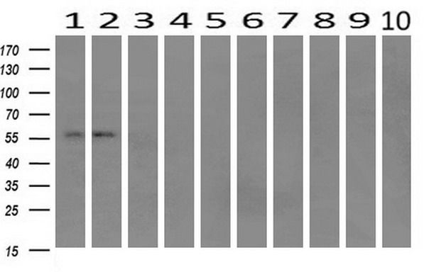 m02652 ifit1 primary antibodies wb testing 2