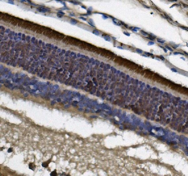  IHC analysis of PDE6 beta/PDE6B using anti-PDE6 beta/PDE6B antibody (M02659-1)