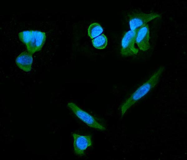  IF analysis of PDE6 beta/PDE6B using anti-PDE6 beta/PDE6B antibody (M02659)