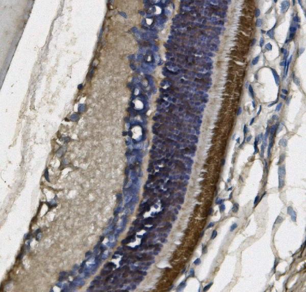  IHC analysis of PDE6 beta/PDE6B using anti-PDE6 beta/PDE6B antibody (M02659)