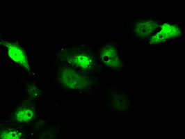m02660 anti serine racemase srr mouse monoclonal antibody clone id oti2e3 if testing 12