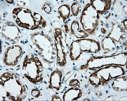 m02660 anti serine racemase srr mouse monoclonal antibody clone id oti2e3 ihc testing 10