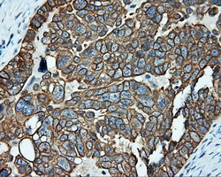 m02660 anti serine racemase srr mouse monoclonal antibody clone id oti2e3 ihc testing 2