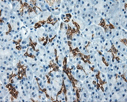 m02660 anti serine racemase srr mouse monoclonal antibody clone id oti2e3 ihc testing 3