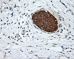 m02660 anti serine racemase srr mouse monoclonal antibody clone id oti2e3 ihc testing 4