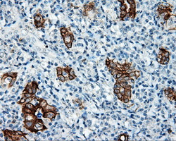 m02660 anti serine racemase srr mouse monoclonal antibody clone id oti2e3 ihc testing 5