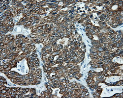 m02660 anti serine racemase srr mouse monoclonal antibody clone id oti2e3 ihc testing 6