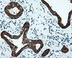 m02660 anti serine racemase srr mouse monoclonal antibody clone id oti2e3 ihc testing 7