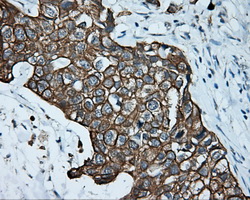m02660 anti serine racemase srr mouse monoclonal antibody clone id oti2e3 ihc testing 8