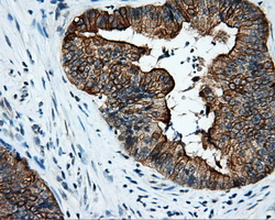 m02660 anti serine racemase srr mouse monoclonal antibody clone id oti2e3 ihc testing 9