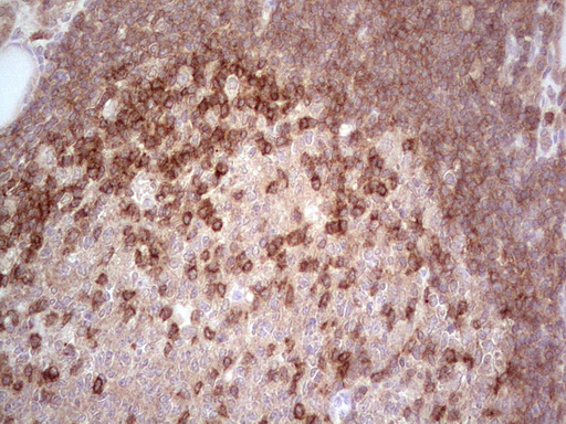 m02666 anti brit1 mcph1 mouse monoclonal antibody clone id oti2a3 ihc testing 2
