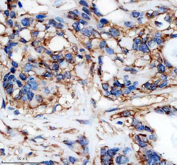 IHC analysis of HRD1/SYVN1 using anti-HRD1/SYVN1 antibody (M02670)
