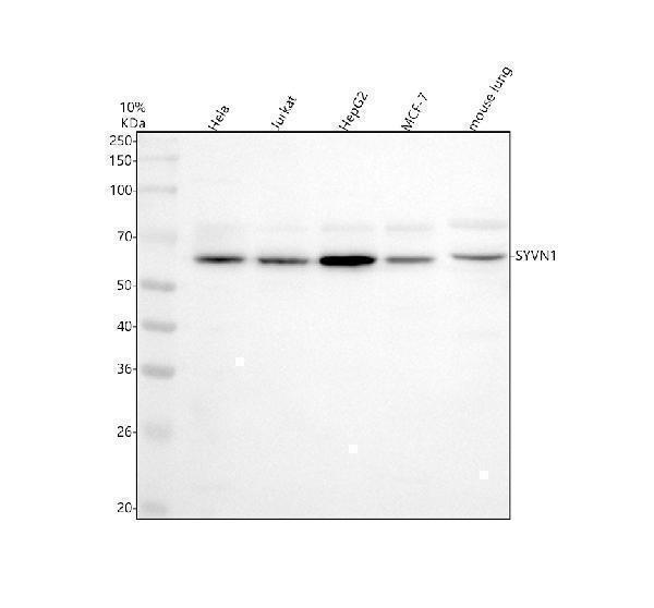 Western blot analysis of HRD1/SYVN1 using anti-HRD1/SYVN1 antibody (M02670)