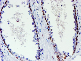 Immunohistochemical staining of paraffin-embedded Human prostate tissue within the normal limits using anti-WWTR1 mouse monoclonal antibody