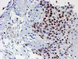 m02672 1 anti taz wwtr1 mouse monoclonal antibody clone id oti1h9 ihc testing 6
