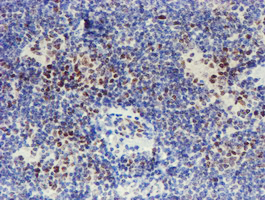 m02672 1 anti taz wwtr1 mouse monoclonal antibody clone id oti1h9 ihc testing 7