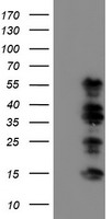 HEK293T cells were transfected with the pCMV6-ENTRY control (Left lane) or pCMV6-ENTRY WWTR1 (Right lane) cDNA for 48 hrs and lysed
