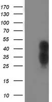 HEK293T cells were transfected with the pCMV6-ENTRY control (Left lane) or pCMV6-ENTRY WWTR1 (Right lane) cDNA for 48 hrs and lysed