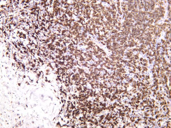 Human tonsil was stained with anti-CD3 rabbit antibody