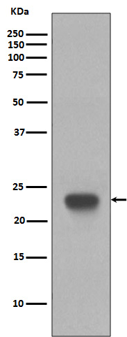 Western blot analysis of CD3 epsilon expression in Jurkat cell lysate