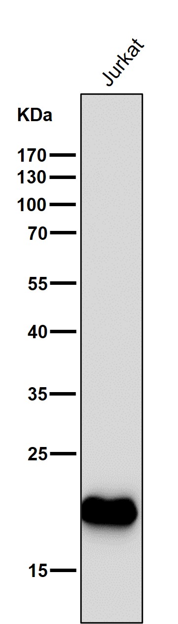 All lanes use the Antibody at 1:1K dilution for 1 hour at room temperature