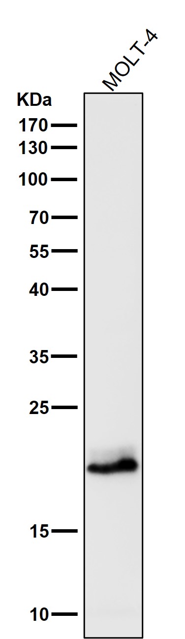 All lanes use the Antibody at 1:1K dilution for 1 hour at room temperature