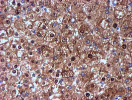 m02676 anti nnmt mouse monoclonal antibody clone id oti3d8 ihc testing 10