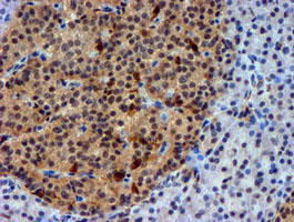 m02676 anti nnmt mouse monoclonal antibody clone id oti3d8 ihc testing 5