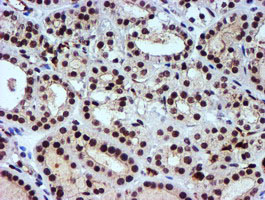 m02676 anti nnmt mouse monoclonal antibody clone id oti3d8 ihc testing 6