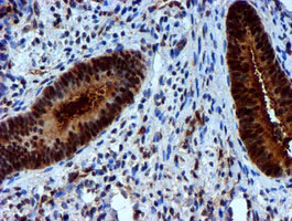 m02676 anti nnmt mouse monoclonal antibody clone id oti3d8 ihc testing 7
